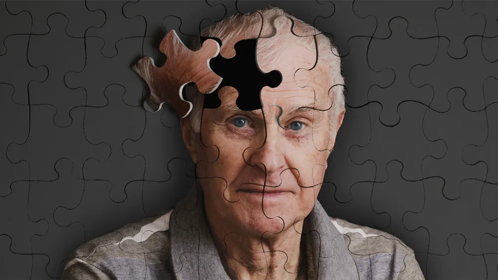 Alzheimer